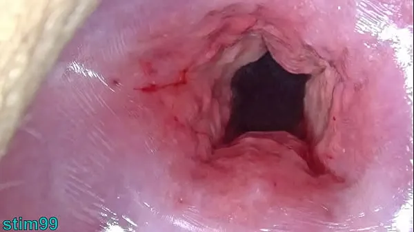 HD Japan Mom Cervix open wide Dilatation and fucking Uterus with Insertion of huge Objects Enerji Klipleri